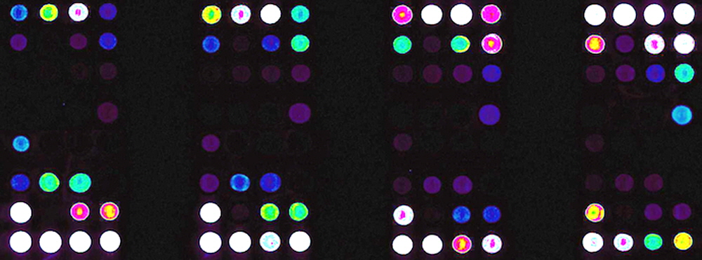 reverse-phase-protein-microarray